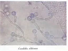 カンジダ症とは？免疫低下で増える身近なカビ菌の正体と対策｜東北のカビ相談はMIST工法®カビバスターズ仙台へ