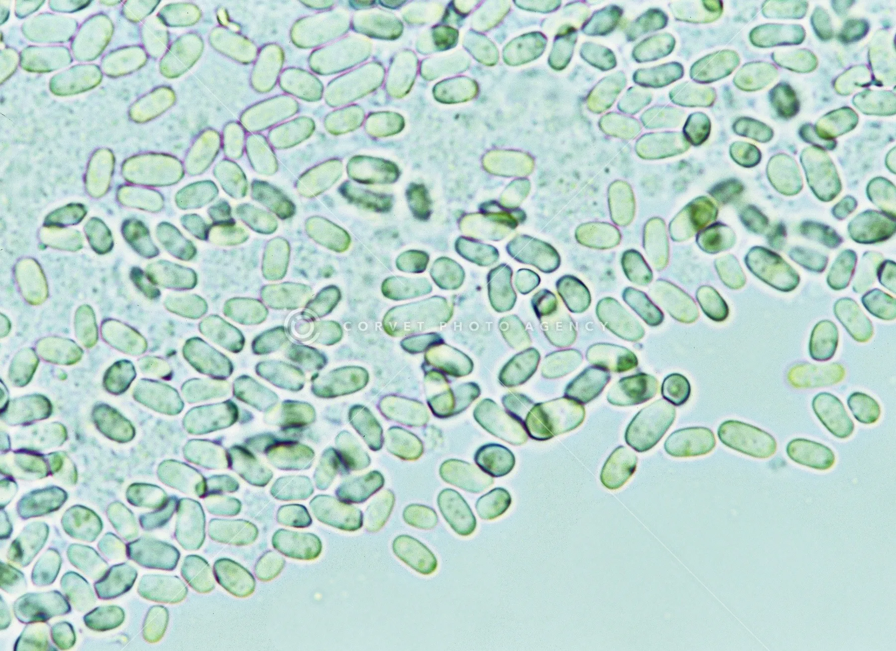 【要注意⚠️アスペルギルス症とは？】咳や息苦しさの原因はカビかも｜空気中に潜む危険と対策をわかりやすく解説！