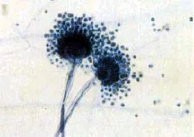 衣替えの落とし穴！クローゼットの奥で見つけた「白い綿」のようなカビ…拭いただけでは再発する理由と正しい対策をわかりやすく解説